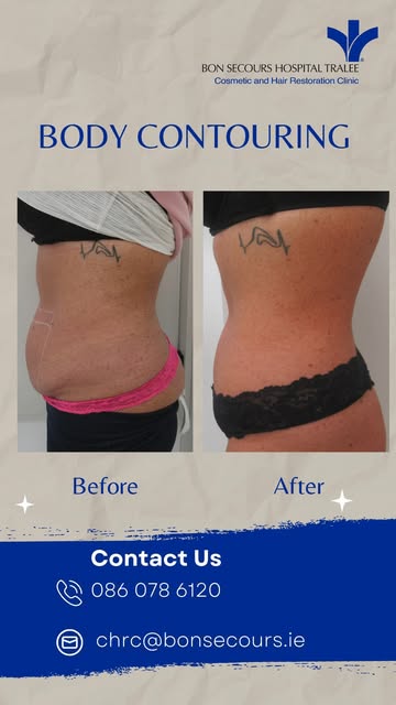 ✨ Watch your confidence transform ✨

Curious about Body Contouring & Fat Reduction? 💫 Take a look a