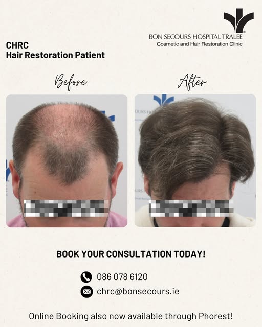 Is your hair affecting your confidence? ✨

Your hair journey is personal — and the right treatment c