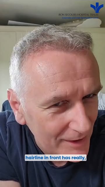#AD Dáithí Diaries: Six months post Hair Restoration! 🌟

Join Dáithí Ó Sé as he shares his incredib