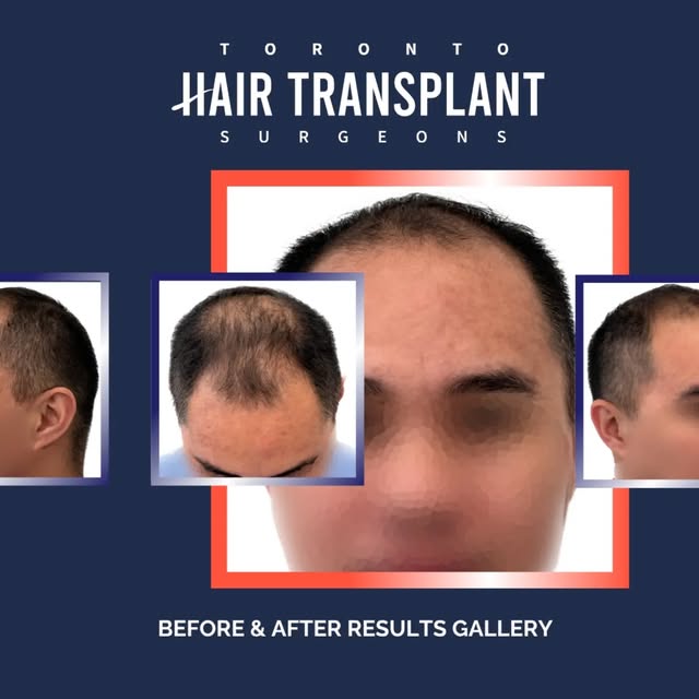 A successful result starts long before the procedure itself.

It begins with understanding the patie