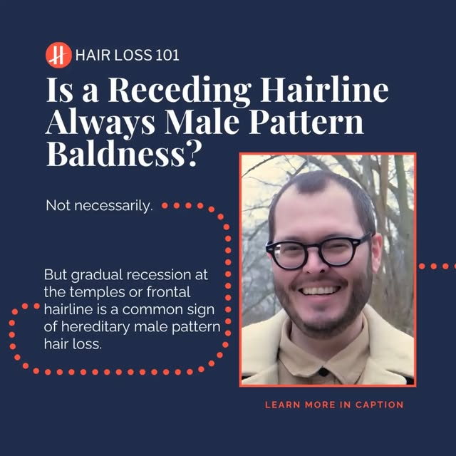 A changing hairline can happen for different reasons, but one of the most common is hereditary male 