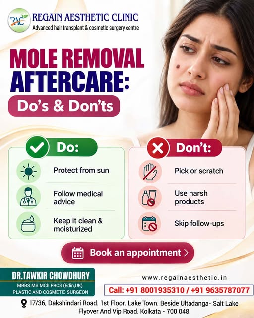Mole Removal Aftercare: The Right Care Makes a Difference!

Proper mole removal aftercare is importa