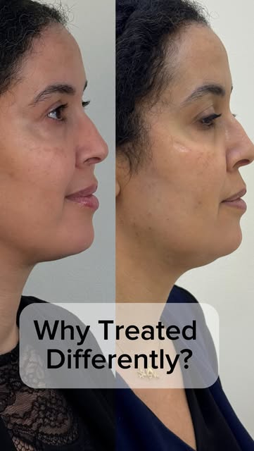 “I feel my face is sagging, and I’m losing volume.”

These three patients described their concern in
