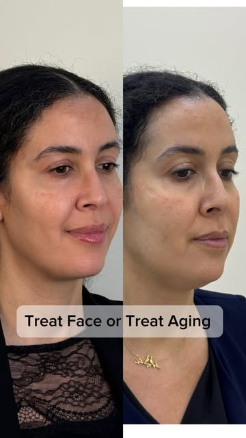 🔺Treating Face is different from Treating Aging...

💡When the early signs of aging start to appear