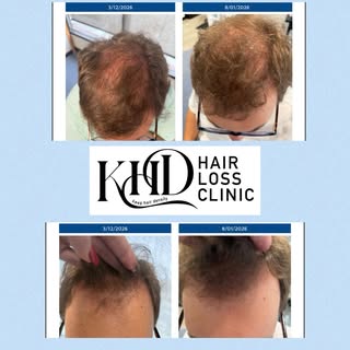 ☀️ First day of August and we’re kicking it off with a great hair check-in!

Met this client back in