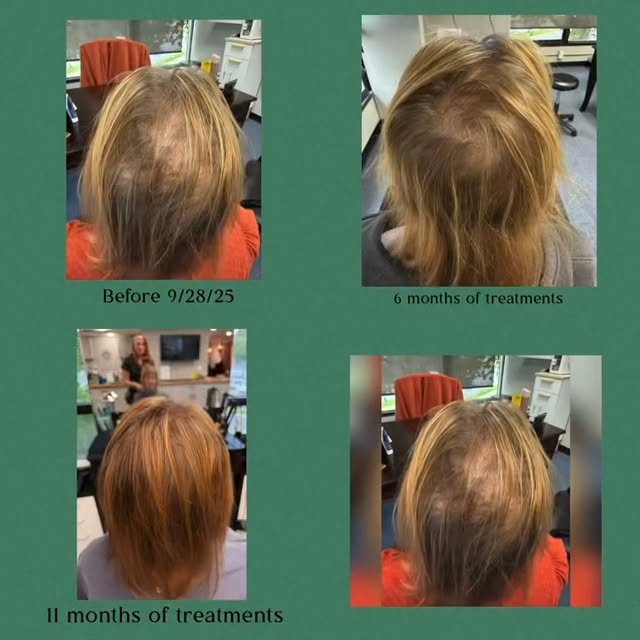 ✨ 11 months. Real results. Real trust in the process. ✨

When this client walked through our doors, 
