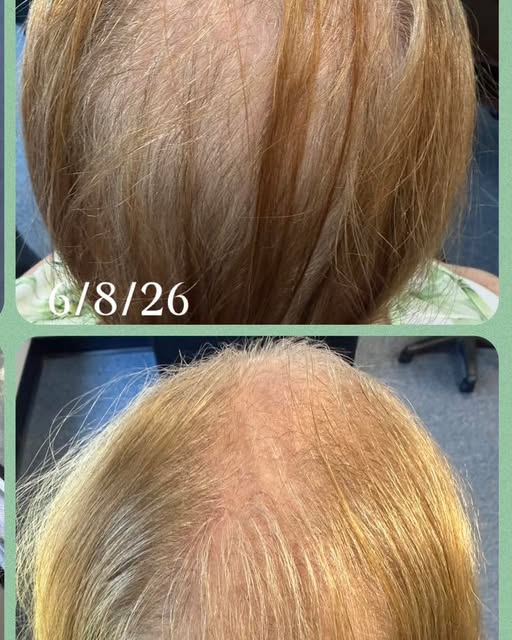 3 months. Real progress. Real results. 💚

From 6/8/26 to 9/9/26, this client has shown up consisten