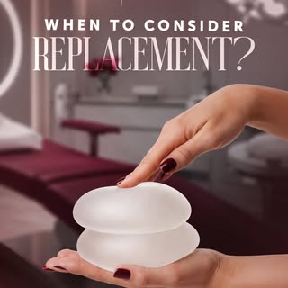 Breast implant replacement conditions today focus on choice rather than expiration. Modern implants 