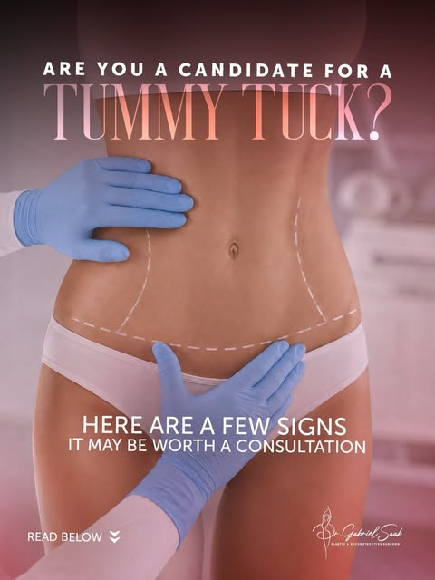 Considering a tummy tuck? If you are struggling with loose skin, weakened abdominal muscles, or stub