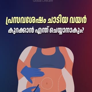 പ്രസവശേഷം ചാടിയ വയർ കുറക്കാൻ എന്ത് ചെയ്യാനാകും? | Postpartum Belly Reduction Explained

After delive