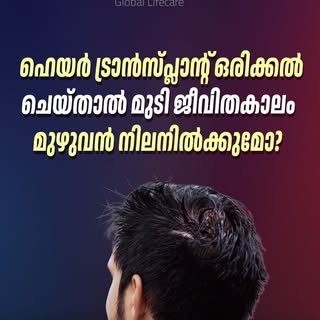 ഹെയർ ട്രാൻസ്‌പ്ലാന്റ് ചെയ്ത മുടി ജീവിതകാലം നിലനിൽക്കുമോ? | Hair Transplant Results Explained

Many p