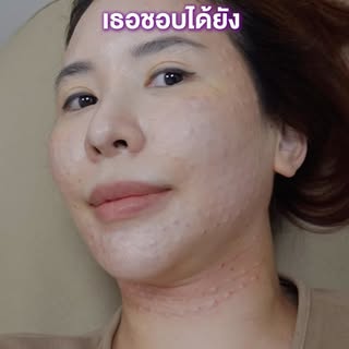 POV: ได้ยินว่าเธอชอบคนหน้าใส…
งั้นขอแวะเติมความมั่นใจแป๊บ 😉💖

#POV #หน้าใส #สายบิวตี้ #ดูแลตัวเอง 