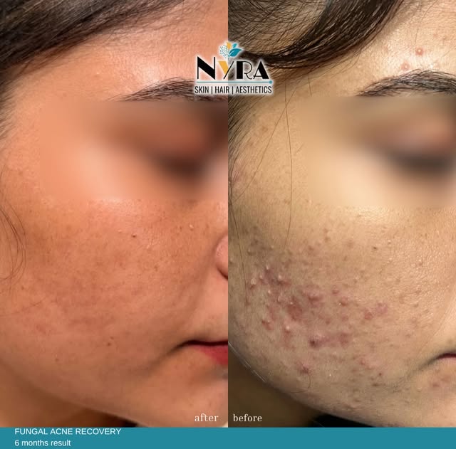 The key to improvement isn’t trying every viral skincare product—it’s getting the right diagnosis an