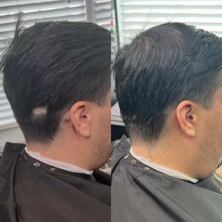 You no longer need to hide your patches.

Hair Units aren’t just for full-head coverage. We speciali