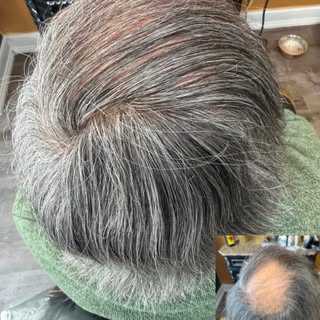 Non surgical hair replacement doesn’t have to be all or nothing.

My top priority is making sure my 