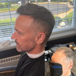 ❕❗️❕❗️
#hairreplacement #hairsystem #njhairreplacement #njhair #nonsurgicalhairloss