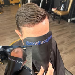 Making the decision to get a hair system is exciting, but it can also feel like a big adjustment at 