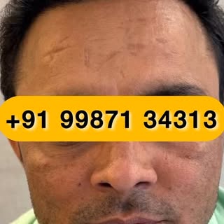•	Outstanding results consistently delivered by Dr. Rizwan and his team at Facethetic Clinic, Mumbai