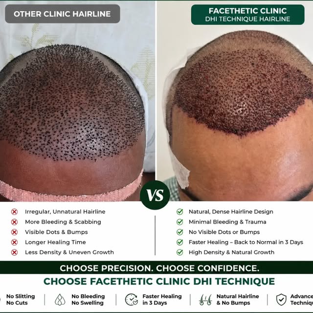 Facethetic clinic at Bandra west Mumbai and Frazer town Bengaluru