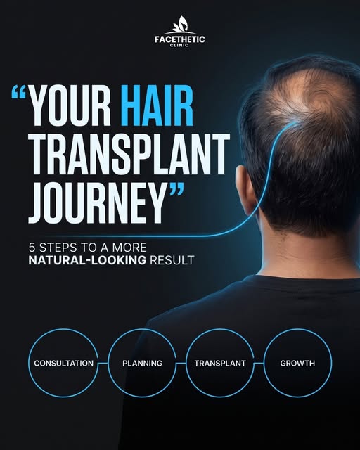 Curious about the hair transplant process? ✨

Swipe to discover our 5-step journey to achieving a na