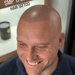 In case you still thinking about SMP treatment ( hair tattoo)

This hair didn’t grow back ... we TAT