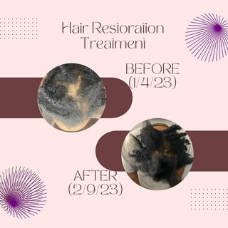 During our consultation this client had one goal- "regrow my hair". As your certified holistic Trich