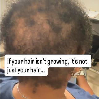 Most people focus on products, oils, and vitamins—but overlook the one thing that actually controls 