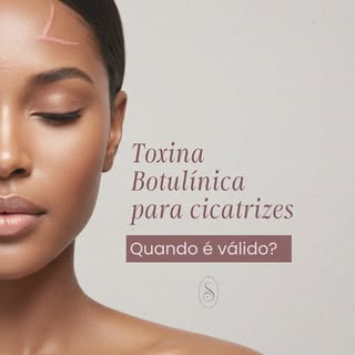 Você sabia que a toxina botulínica pode ser usada como aliada no tratamento de algumas cicatrizes?

