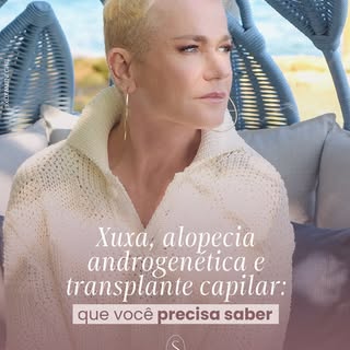 O caso da Xuxa trouxe à tona um tema importante: a alopecia androgenética também atinge mulheres, e 
