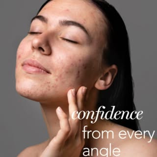 What’s underneath?
Strength. Confidence. Clearer skin.

@AviClear helps bring it forward — so you fe