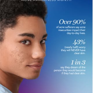 There’s power in feeling good in your skin.

 Treat acne differently — treat it with 
@AviClear.
#AA