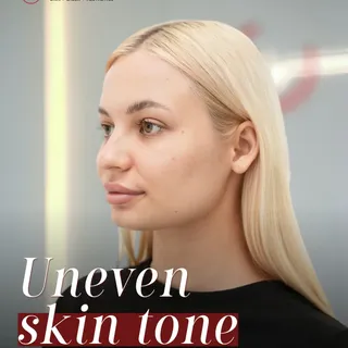 Uneven tone does not come from nowhere

Dead cells build up
and make the skin look dull

Peeling rem
