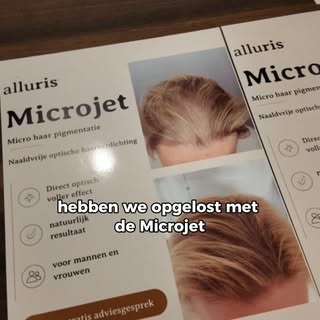 Van een zichtbare kruin tot fijn haar of beginnende kaalheid: 
haaruitval ziet er bij iedereen ander