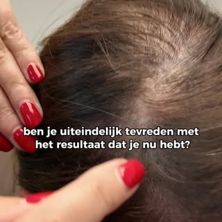 Een eerlijk verhaal over dunner haar 🤍

Kelly probeerde eerder al:

✨ vitamines
🌿 probiotica
✨ mes