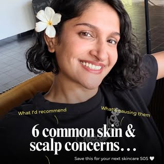 Comment “SKIN” and I’ll share these links with you.
Save this for your next skincare SOS. 🤍

skinca