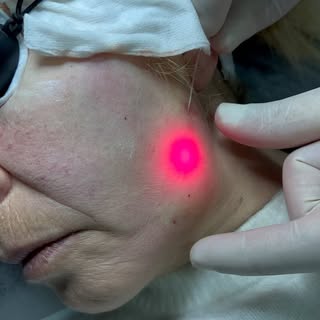 👉🏼Quieres reducir las arrugas y líneas finas de la piel, mejorar la textura y ayudar en la regener
