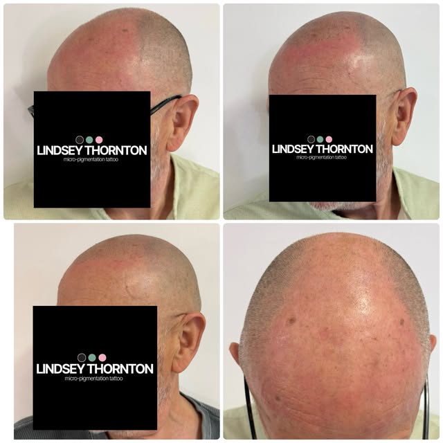 First and second sessions for my client shown here.  Before photos show the area I have started to l