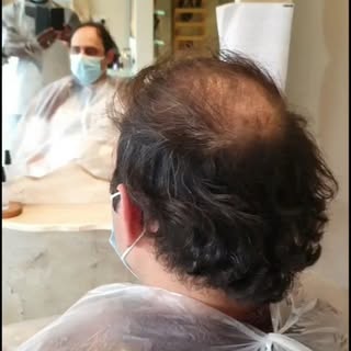 ** AS SHOWN ON 
ITV ‘THIS MORNING ‘ . 
Hector's Mens  Hair Replacement  Unit System.  Hector’s alway