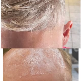 ** AS SHOWN ON 
ITV ‘THIS MORNING ‘ . 
Hector’s Mens  Hair Replacement  Unit System.  Hector’s alway