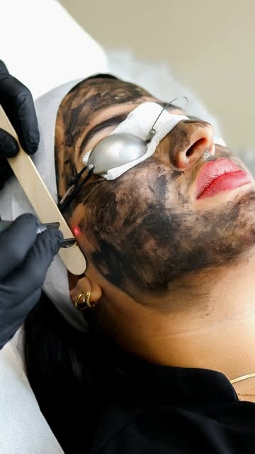 Get the ultimate red-carpet glow with zero downtime! ✨

Book Your Appointments:
Call or WhatsApp
📞�