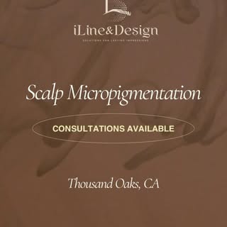 Thinning temples can be softened with Scalp Micropigmentation. SMP creates the appearance of fuller 