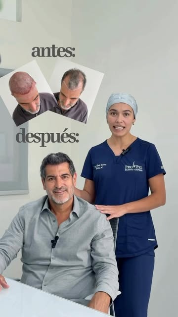 Verme joven con injerto ✅ 
Verme aún más joven con Botox 😮‍💨
Agenda por WhatsApp al 3351079332 📲
