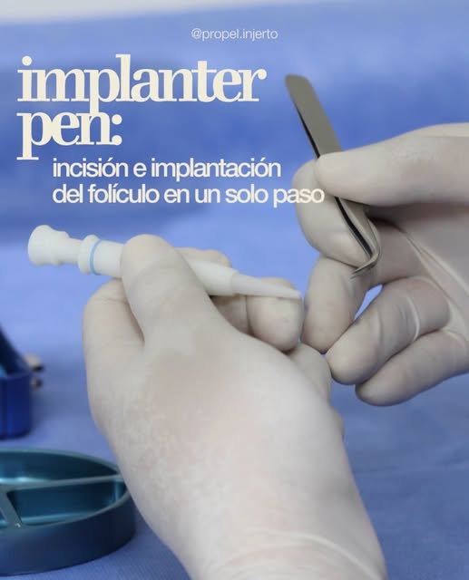 En ProPel utilizamos la herramienta Implanter Pen para la técnica DUI durante la implantación de fol