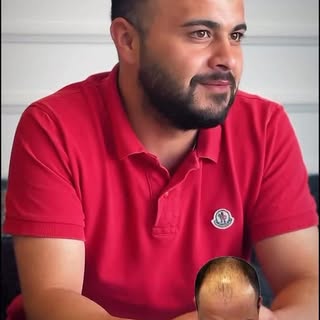 Ozan Dölek 5000 GREFT 12.Ay Sonuç!💣

Kafanıza Takmayın Kolayı Var!!!
Detaylı bilgilendirme ve rande