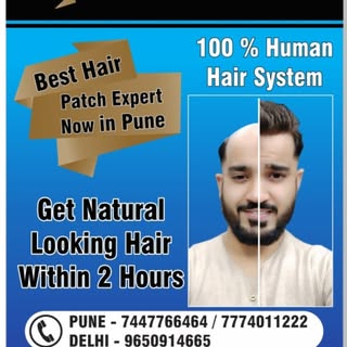 Get #Freedom From Baldness
Non Surgical #Hair Restoration.
With No Scar No #Surgery