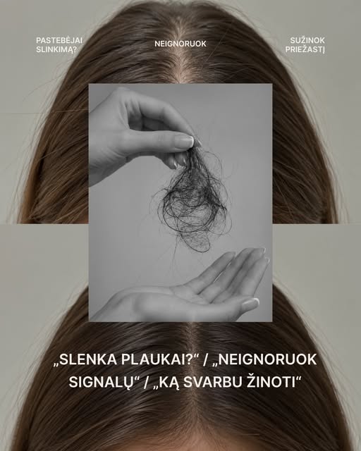HAIR TALK // APIE PLAUKŲ SLINKIMĄ … 

Pastaruoju metu, o ypač artėjant rudeniui, vis dažniau girdžiu