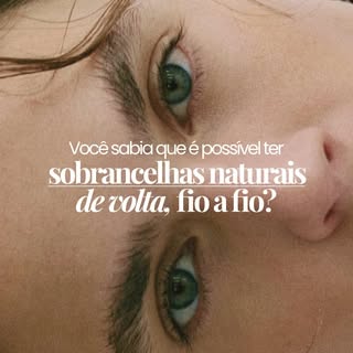 ✨ Sobrancelhas naturais de volta, fio a fio.

O transplante de sobrancelhas é um procedimento defini