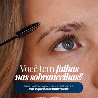 O MMP é a tecnologia que fortalece fios e devolve densidade às sobrancelhas. Resultados naturais, pr