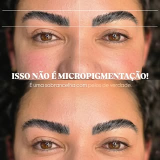 Você ainda não sabe o que é TransplantedeSobrancelhas?

Na verdade, trata-se de um procedimento que 