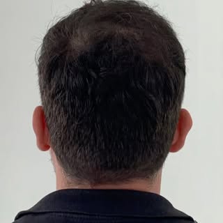 É sobre autoestima e bem estar que estamos falando. 
Nesse vídeo mostramos o resultado de quase 1 an